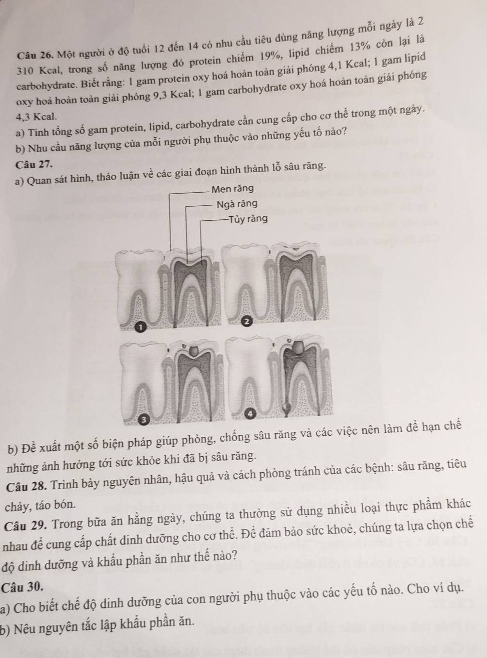 Một người ở độ tuổi 12 đến 14 có nhu cầu tiêu dùng năng lượng mỗi ngày là 2
310 Kcal, trong số năng lượng đó protein chiếm 19%, lipid chiếm 13% còn lại là 
carbohydrate. Biết rằng: 1 gam protein oxy hoá hoàn toàn giải phóng 4,1 Kcal; 1 gam lipid 
oxy hoá hoàn toàn giải phóng 9,3 Kcal; 1 gam carbohydrate oxy hoá hoàn toàn giải phóng
4, 3 Kcal. 
a) Tính tổng số gam protein, lipid, carbohydrate cần cung cấp cho cơ thể trong một ngày. 
b) Nhu cầu năng lượng của mỗi người phụ thuộc vào những yếu tố nào? 
Câu 27. 
a) Quan sát hình, thảo luận về các giai đoạn hình thành lỗ sâu răng. 
b) Đề xuất một số biện pháp giúp phòng, chống sâu răng và ệc nên làm để hạn chế 
những ảnh hưởng tới sức khỏe khi đã bị sâu răng. 
Câu 28. Trình bày nguyên nhân, hậu quả và cách phòng tránh của các bệnh: sâu răng, tiêu 
chảy, táo bón. 
Câu 29. Trong bữa ăn hằng ngày, chúng ta thường sử dụng nhiều loại thực phẩm khác 
nhau để cung cấp chất dinh dưỡng cho cơ thể. Để đảm bảo sức khoẻ, chúng ta lựa chọn chế 
độ dinh dưỡng và khẩu phần ăn như thế nào? 
Câu 30. 
a) Cho biết chế độ dinh dưỡng của con người phụ thuộc vào các yếu tố nào. Cho ví dụ. 
b) Nêu nguyên tắc lập khẩu phần ăn.