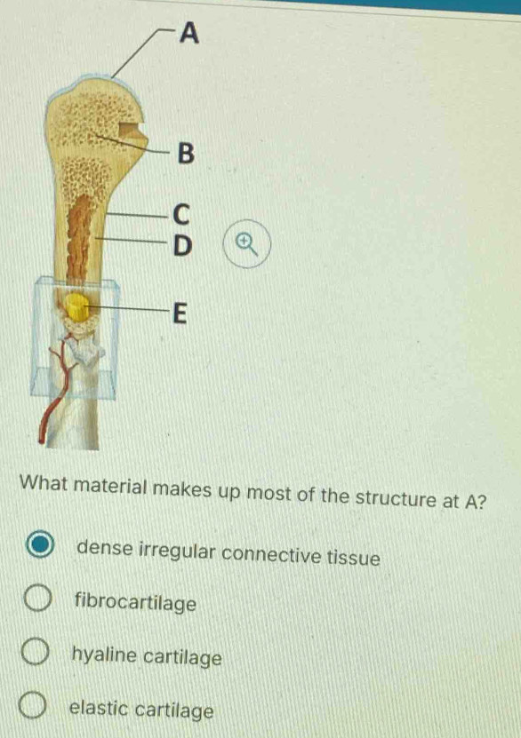 What material makes up most of the structure at A?
dense irregular connective tissue
fibrocartilage
hyaline cartilage
elastic cartilage