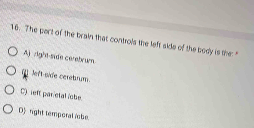 The part of the brain that controls the left side of the body is the: "
A) right-side cerebrum.
left-side cerebrum.
C) left parietal lobe.
D) right temporal lobe.