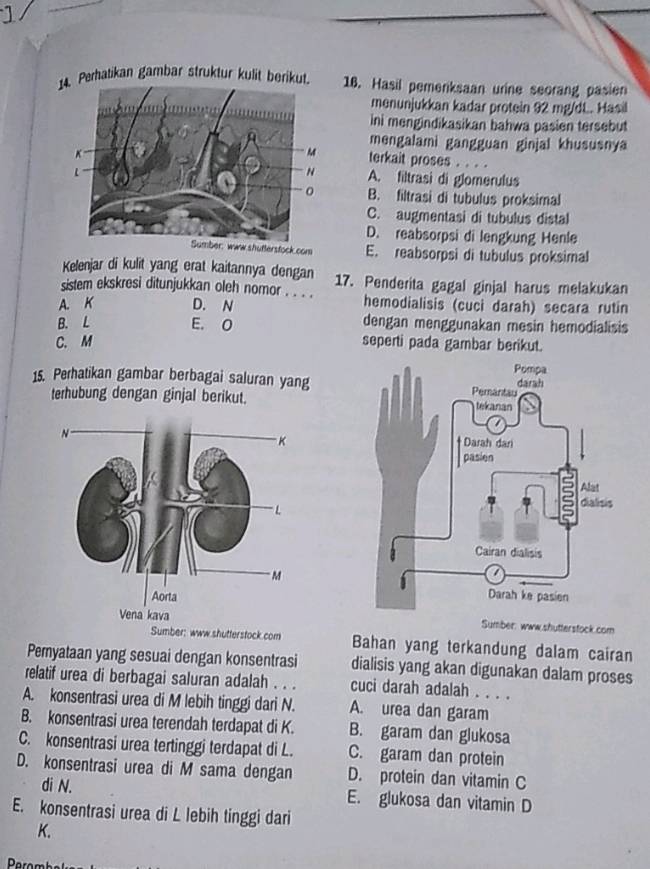 Perhatikan gambar struktur kulit berikut.16. Hasil pemenksaan urine seorang pasien
menunjukkan kadar protein 92 mg/dL. Hasil
ini mengindikasikan bahwa pasien tersebut
mengalami gangguan ginjal khususnya
terkait proses . . . .
A. filtrasi di glomerulus
B. filtrasi di tubulus proksimal
C. augmentasi di tubulus distal
D. reabsorpsi di lengkung Henle
m E. reabsorpsi di tubulus proksimal
Kelenjar di kulit yang erat kaitannya dengan
sistem ekskresi ditunjukkan oleh nomor . .  . 17. Penderita gagal ginjal harus melakukan
A. K D. N hemodialisis (cucì darah) secara rutin
B. L E. O dengan menggunakan mesin hemodialisis
C. M seperti pada gambar berikut.
15. Perhatikan gambar berbagai saluran yang
terhubung dengan ginjal berikut.
 
Sumber: www.shuttersfock.com
.shutterstock.com Bahan yang terkandung dalam cairan
Pemyataan yang sesuai dengan konsentrasi dialisis yang akan digunakan dalam proses
relatif urea di berbagai saluran adalah . . . cuci darah adalah . . . .
A. konsentrasi urea di M lebih tinggi dari N. A. urea dan garam
B. konsentrasi urea terendah terdapat di K. B. garam dan glukosa
C. konsentrasi urea tertinggi terdapat di L. C. garam dan protein
D. konsentrasi urea di M sama dengan D. protein dan vitamin C
di N. E. glukosa dan vitamin D
E. konsentrasi urea di L lebih tinggi dari
K.