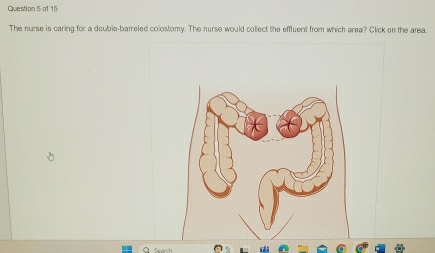 The nurse is caring for a double-barreled colostomy. The nurse would collect the effluent from which area? Click on the area.