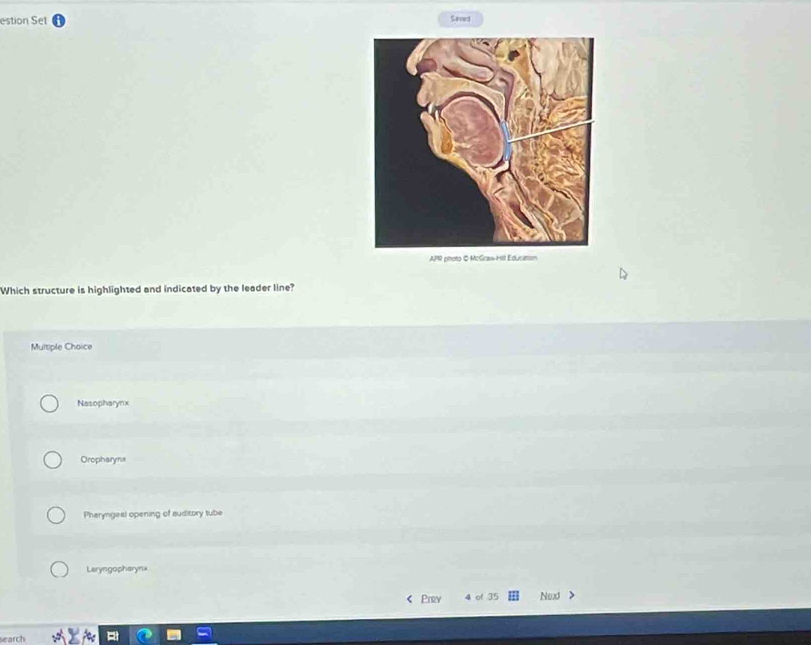 estion Set
Saved
APR photo & McGrav-Hill Educition
Which structure is highlighted and indicated by the leader line?
Multiple Choice
Nasopharynx
Oropharyrux
Pharyngeal opening of auditory tube
Leryngopharynx
Prev 4 of 35 Nexd
search