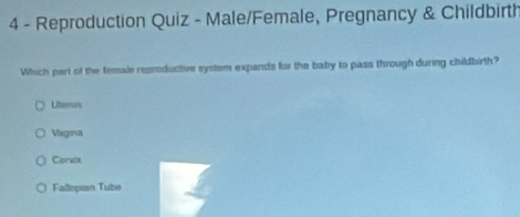 Reproduction Quiz - Male/Female, Pregnancy & Childbirth
Which part of the female reproductive system expands for the baby to pass through during childbirth?
Uteras
Vagina
Cervix
Fallepıan Tube