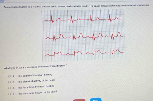 An electrocardiogram is a test that doctors use to assess cardiovascular health. The image below shows data given by an electrocardiogram.
What type of data is recorded by the electrocardiogram?
A. the sound of the heart beating
B. the electrical activity of the heart
C. the force from the heart beating
D. the amount of oxygen in the blood