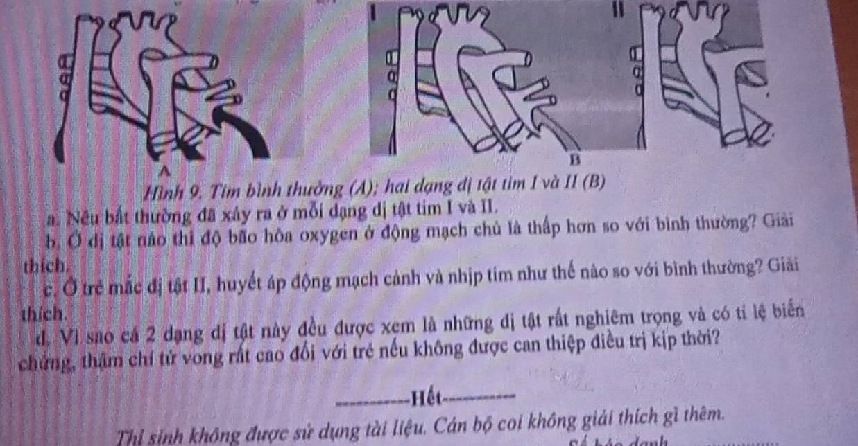 Hình 9. Tim bình thưởng (A); hai dạng đị tậ Ⅱ (B) 
a. Nều bất thường đã xây ra ở mỗi dạng dị tật tim I và II. 
b. Ở đị tật nào thi độ bão hòa oxygen ở động mạch chủ là thấp hơn so với bình thường? Giải 
thích. 
c. Ở trẻ mắc đị tật II, huyết áp động mạch cảnh và nhịp tim như thế nào so với bình thường? Giải 
thích. 
d. Vì sao cá 2 dạng đị tật này đều được xem là những đị tật rất nghiêm trọng và có tỉ lệ biển 
chứng, thậm chí tử vong rất cao đổi với trẻ nếu không được can thiệp điều trị kịp thời? 
_Hết_ 
Thỉ sinh không được sử dụng tài liệu. Cán bộ coi không giải thích gì thêm.