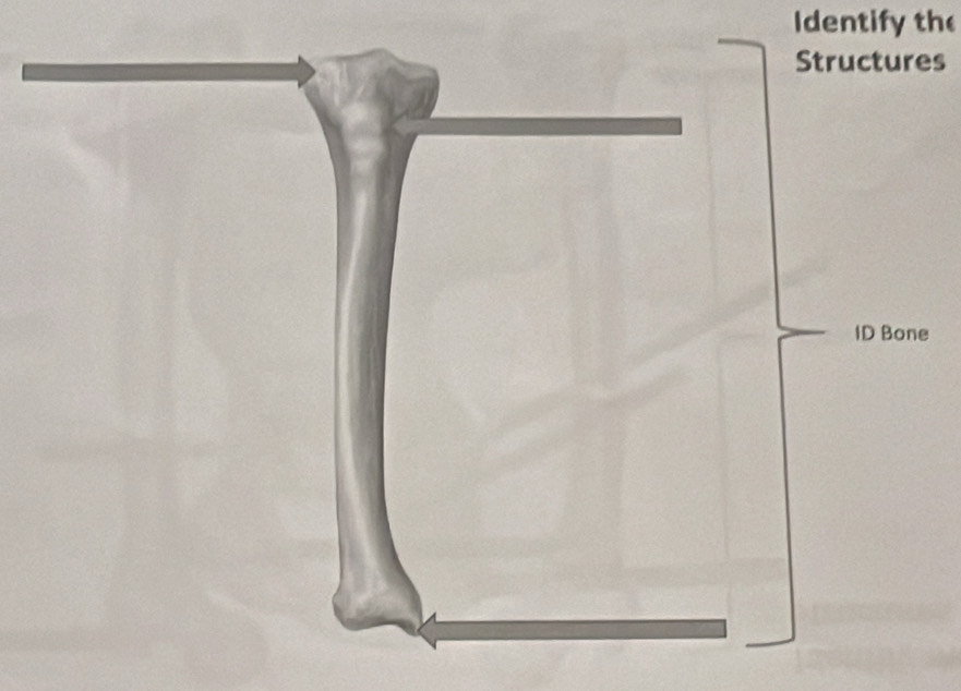 dentify the 
Structures 
ID Bone