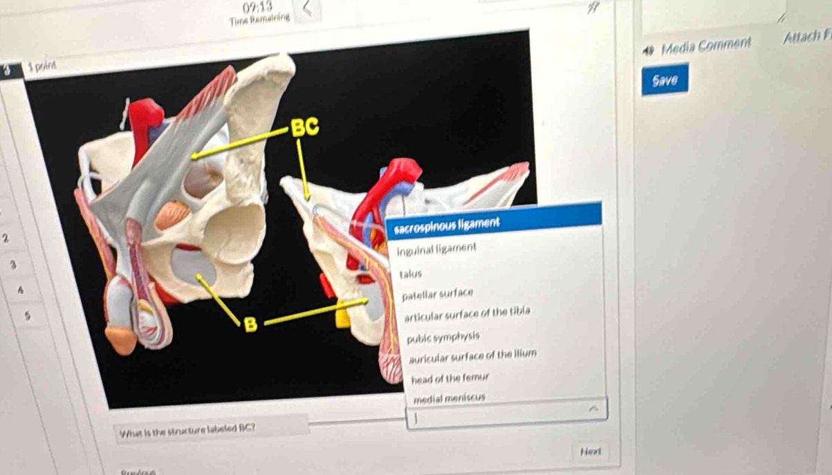 09:13 
Time Remaining 
edia Comment Attach 
a 
ve 
2 
3 
^ 
What is the structure labeled BC? 
Next