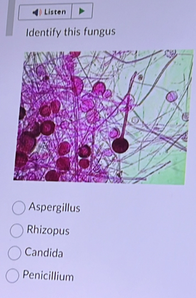 Listen
Identify this fungus
Aspergillus
Rhizopus
Candida
Penicillium