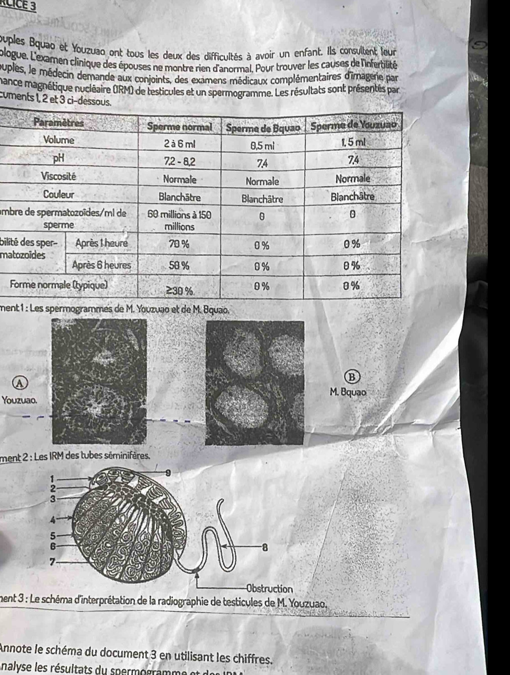 RCICE 3 
ouples Bquao et Youzuao ont tous les deux des difficultés à avoir un enfant. Ils consultent leur 
ologue. L'examen clinique des épouses ne montre rien d'anormal, Pour trouver les causes de l'infertilité 
ouples, le médecin demande aux conjoints, des examens médicaux complémentaires d'imagerie par 
mance magnétique nucléaire (IRM) de testicules et un spermogramme. Les résultats sont présentés par 
cuments 1, 2 et 
am 
bili 
ma 
F 
ment 1 : Les spermogrammes de M. Youzuao et de M. Bquao. 
B 
A 
M. Bquao 
Youzuao. 
ment 2 : Les IRM des tubes séminifères. 
ment 3 : Le schéma d'interprétation de la radiographie de testicules de M. Youzuao. 
Annote le schéma du document 3 en utilisant les chiffres. 
Analyse es rés ltat u per g a mm