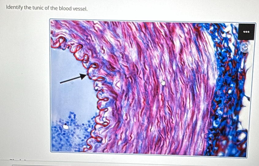 Identify the tunic of the blood vessel.