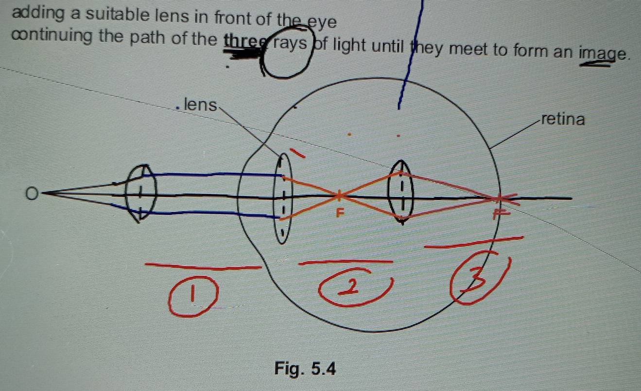 adding a suitable lens in front of the eye 
continuing the path of the three rays of light until they meet to form an image. 
Fig. 5.4