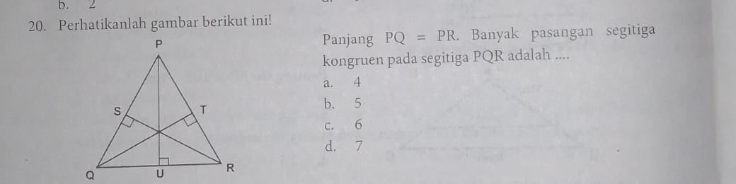 b. 2
20. Perhatikanlah gambar berikut ini!
. Banyak pasangan segitiga
Panjang PQ=PR. 
kongruen pada segitiga PQR adalah ....
a. 4
b. 5
c. 6
d. 7