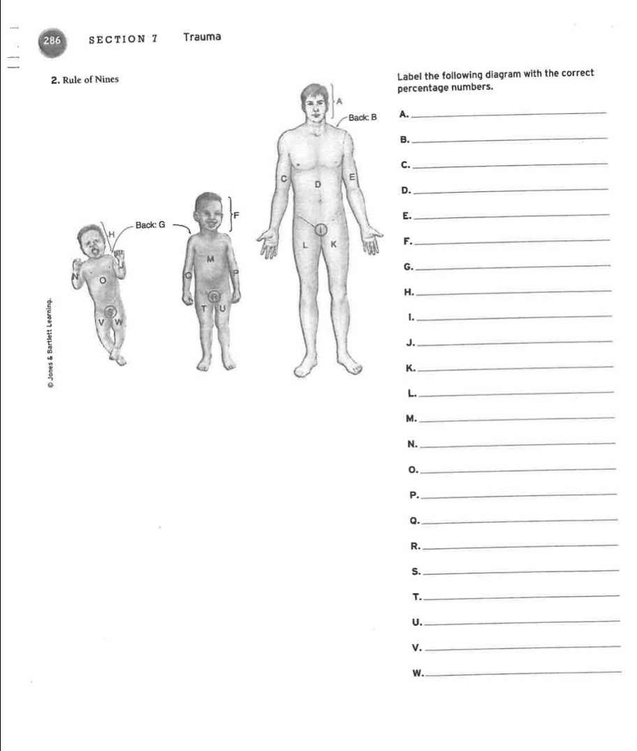 286 SECTION 7 Trauma 
Label the following diagram with the correct 
percentage numbers. 
A. 
_ 
B._ 
C. 
_ 
D._ 
E. 
_ 
F._ 
G. 
_ 
H. 
_ 
1. 
_ 
J._ 
K._ 
L._ 
M. 
_ 
N._ 
0. 
_ 
P._ 
Q. 
_ 
R._ 
S._ 
T._ 
U._ 
V._ 
W._