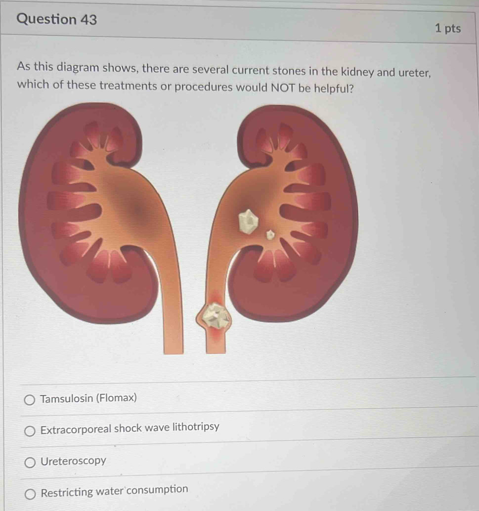 As this diagram shows, there are several current stones in the kidney and ureter,
which of these treatments or procedures would NOT be helpful?
Tamsulosin (Flomax)
Extracorporeal shock wave lithotripsy
Ureteroscopy
Restricting water consumption