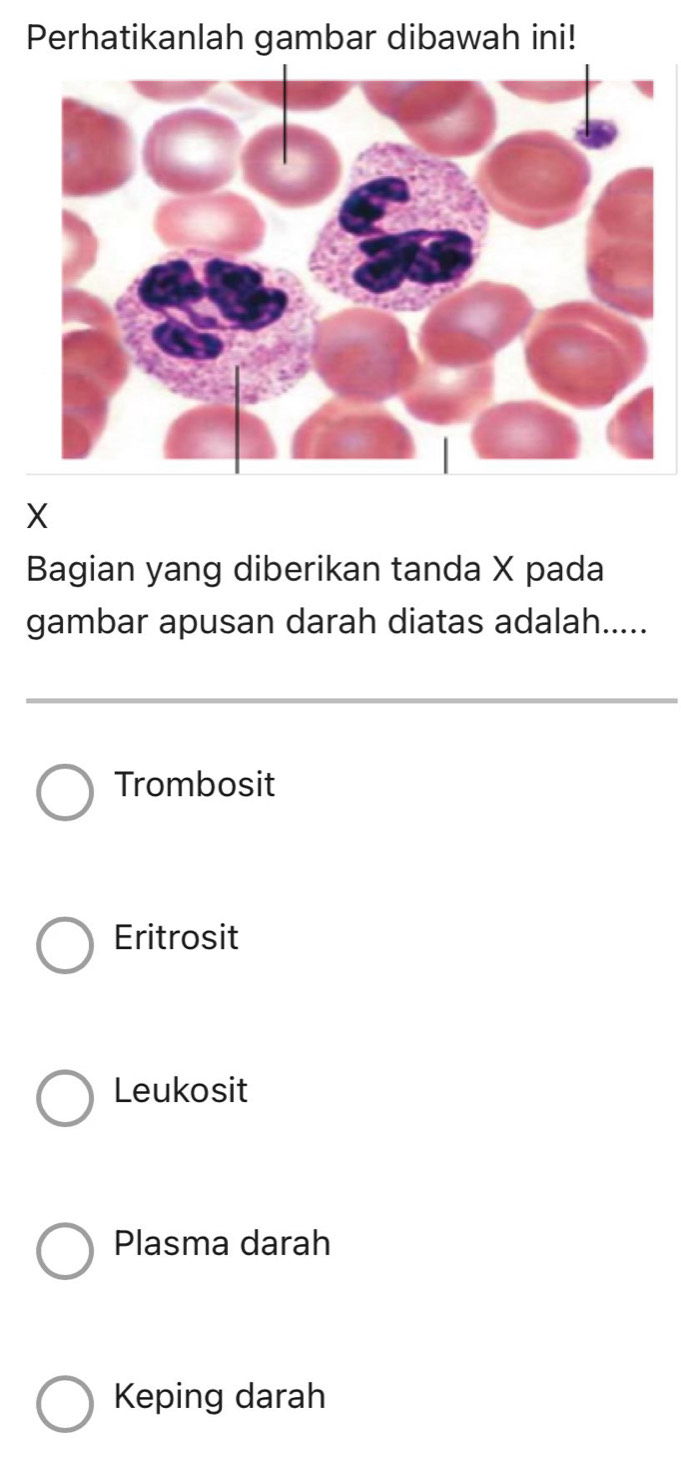 Perhatikanlah gambar dibawah ini!
X
Bagian yang diberikan tanda X pada
gambar apusan darah diatas adalah.....
Trombosit
Eritrosit
Leukosit
Plasma darah
Keping darah