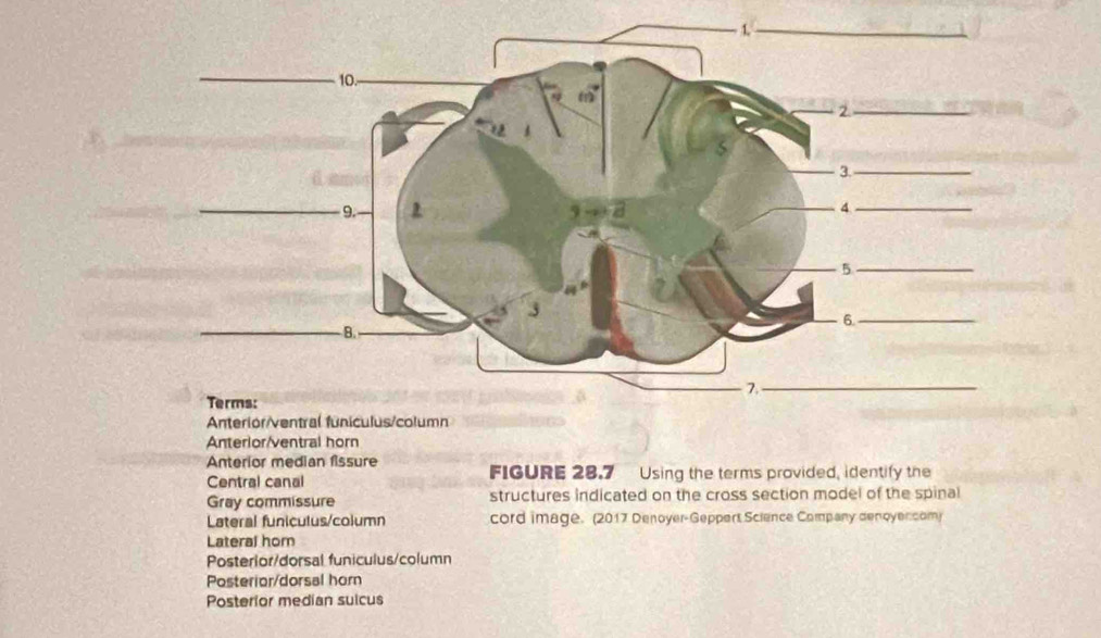 Solved: Anterior/ventral horn Anterior median fissure Central canal ...