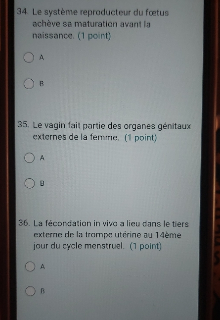 Le système reproducteur du fœtus
achève sa maturation avant la
naissance. (1 point)
A
B
35. Le vagin fait partie des organes génitaux
externes de la femme. (1 point)
A
B
36. La fécondation in vivo a lieu dans le tiers
externe de la trompe utérine au 14ème
jour du cycle menstruel. (1 point)
A
B