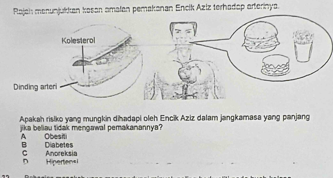 Rajah menunjukkan kosan amalan pemakanan Encik Aziz terhadap arterinya.
Apakah risiko yang mungkin dihadapi oleh Encik Aziz dalam jangkamasa yang panjang
jika beliau tidak mengawal pemakanannya?
A Obesiti
B Diabetes
C Anoreksia
D Hipertensi