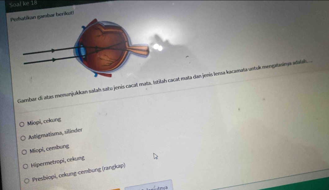 Soal ke 18
Perhatikan gambar berikut!
Gambar di atas menunjukkan salah satu jenis cacat mata. Istilah cacat mata dan jenis lensa kacamata untuk mengatasinya adalah....
Miopi, cekung
Astigmatisma, silinder
Miopi, cembung
Hipermetropi, cekung
Presbiopi, cekung-cembung (rangkap)