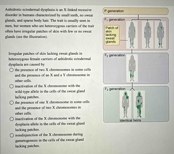 Anhidrotic ectodermal dysplasia is an X-linked recessive 
disorder in humans characterized by small teeth, no sweat
glands, and sparse body hair. The trait is usually seen in 
men, but women who are heterozygous carriers of the trait 
often have irregular patches of skin with few or no sweat 
glands (see the illustration). 
Irregular patches of skin lacking sweat glands in 
heterozygous female carriers of anhidrotic ectodermal
dysplasia are caused by
the presence of two X chromosomes in some cells
and the presence of an X and a Y chromosome in
other cells.
inactivation of the X chromosome with the
wild-type allele in the cells of the sweat gland 
lacking patches.
the presence of one X chromosome in some cells
and the presence of two X chromosomes in
other cells.
inactivation of the X chromosome with the 
dysplasia allele in the cells of the sweat gland
lacking patches.
nondisjunction of the X chromosome during
gametogenesis in the cells of the sweat gland
lacking patches.