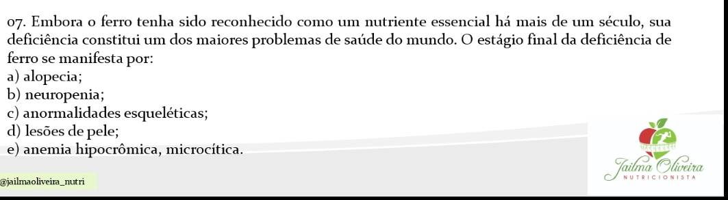 Embora o ferro tenha sido reconhecido como um nutriente essencial há mais de um século, sua
deficiência constitui um dos maiores problemas de saúde do mundo. O estágio final da deficiência de
ferro se manifesta por:
a) alopecia;
b) neuropenia;
c) anormalidades esqueléticas;
d) lesões de pele;
e) anemia hipocrômica, microcítica.
Jailma Olíveira
@jailmaoliveira_nutri
N UTRIC IO N IS TA