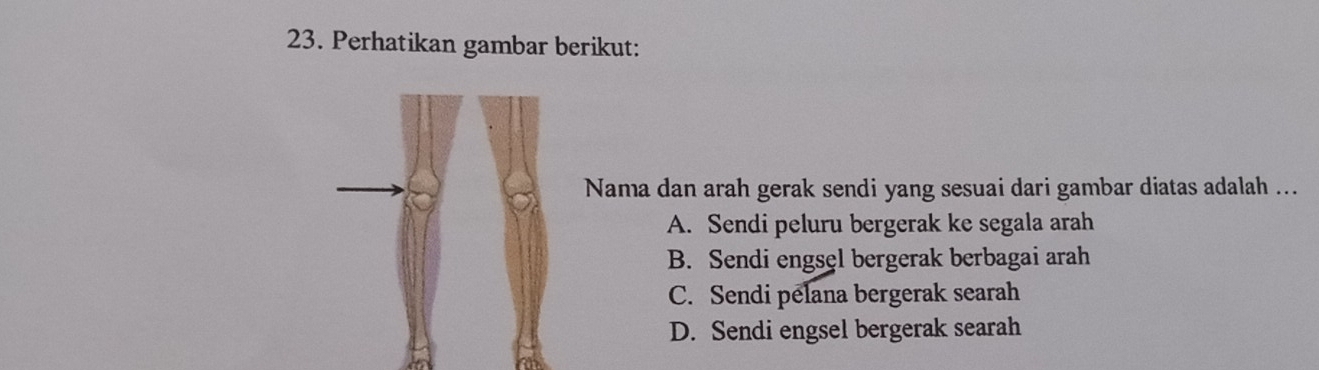 Perhatikan gambar berikut:
Nama dan arah gerak sendi yang sesuai dari gambar diatas adalah ...
A. Sendi peluru bergerak ke segala arah
B. Sendi engsęl bergerak berbagai arah
C. Sendi pelana bergerak searah
D. Sendi engsel bergerak searah