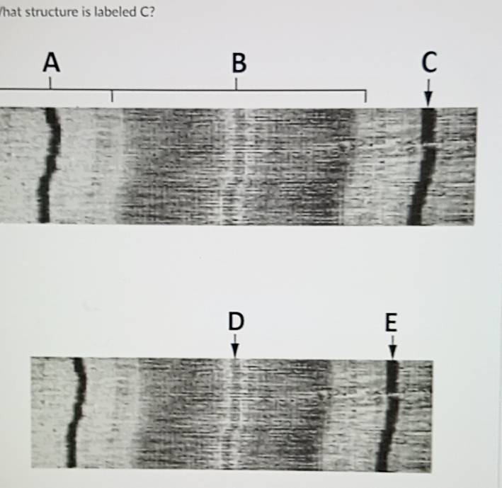 Solved: hat structure is labeled C? [Biology]