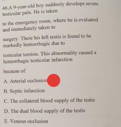 A 9-year-old boy suddenly develops severe
testicular pain. He is taken
to the emergency room, where he is evaluated
and immediately taken to
surgery. There his left testis is found to be
markedly hemorrhagic due to
testicular torsion. This abnormality caused a
hemorrhagic testicular infarction
because of
A. Arterial occlusion
B. Septic infarction
C. The collateral blood supply of the testis
D. The dual blood supply of the testis
E. Venous occlusion