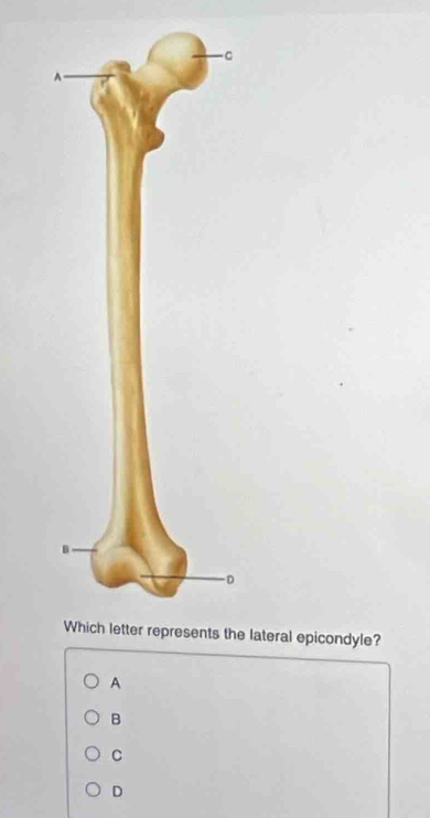 A
e lateral epicondyle?
A
B
C
D