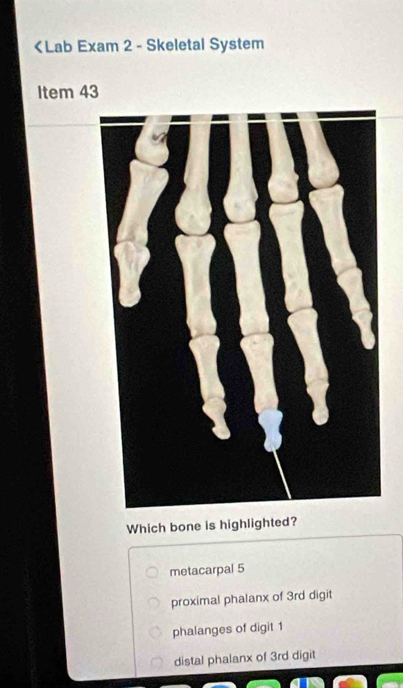 metacarpal 5
proximal phalanx of 3rd digit
phalanges of digit 1
distal phalanx of 3rd digit