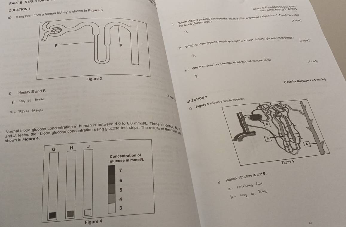 STRUCTUR
QUESTION 1
Centre of Fourdation Studies, UITM
a) A nephron from a human kidney is shown in Figure 3
Foundation Biology II / BIO095
I Which student probably has diabetes, eaten a cake, and needs a high amount of insulin to contro
his blood glucose level?
(1 mark)
G
(1 mark)
iI Which student probably needs glucagon to control his blood glucose concentration?
G
iii) Which student has a healthy blood glucose concentration?
(1 mark)
(Total for Question 1=5 marks)
i) Identify E and F.
(2 man
£ - loup uf Henic
QUESTION 2
a) Figure 5 sh
F - brotm
Normal blood glucose concentration in human is between 4.0 to 6.6 mmol/L. Three students, G. H
and J, tested their blood glucose concentration using glucose test strips. The results of their test an
shown in Figur
i) Identify structure A and B.
A - Cullecting dust
5 w
Fi
67