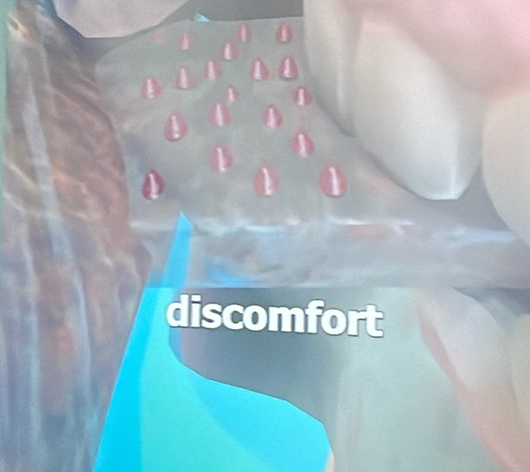 discomfort