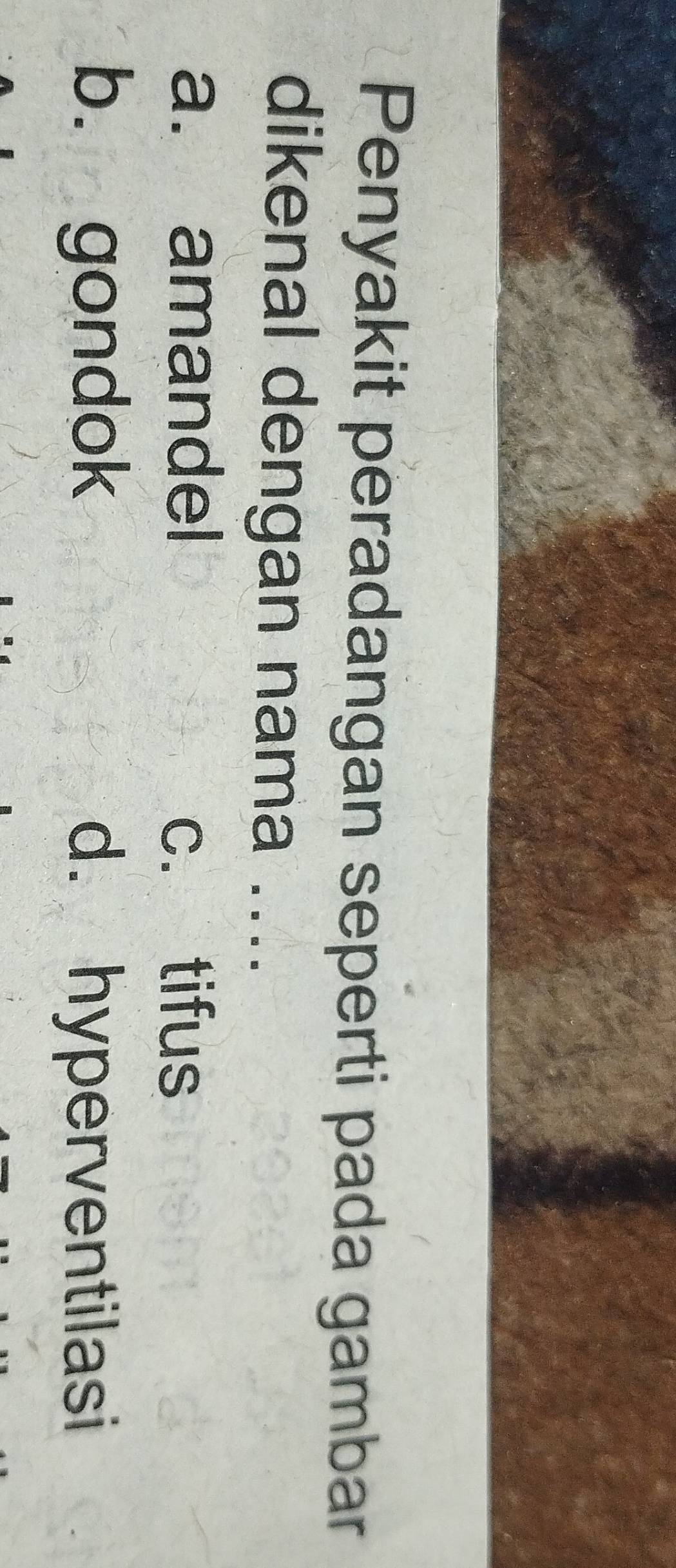 Penyakit peradangan seperti pada gambar
dikenal dengan nama ....
a. amandel
c. tifus
b. gondok d. hyperventilasi