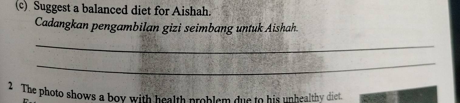 Suggest a balanced diet for Aishah. 
Cadangkan pengambilan gizi seimbang untuk Aishah. 
_ 
_ 
2 The photo shows a boy with health problem due to his unhealthy diet.