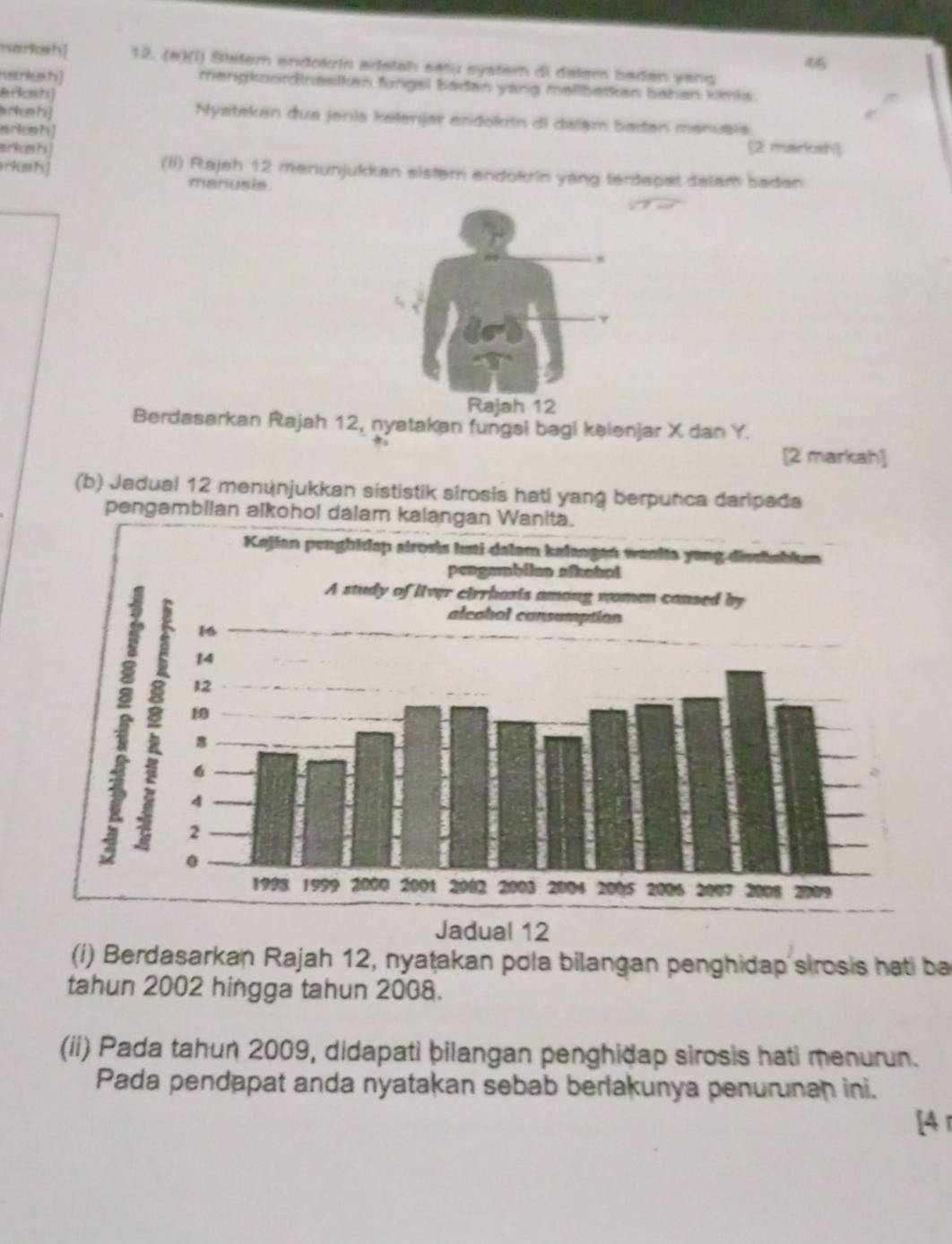 warlosh] 12. (ə)(i) Steter endokrin adatah satu syster di delem baden yang 
nanksh rangkoordinasikan fungel badan yang mallbatkan bahen kimia. 
ær? cm?) 
riceh] Nyatekan đua jenia kelenjar endokrin di dalam badan manuais 
mriem?] 
mrkcnshs [2 marksh] 
rkeh! (ii) Rajah 12 menunjukkan sister andokrin yang terdapat dalam baden 
marusis. 
Rajah 12 
Berdasarkan Rajah 12, nyatakan fungsi bagi kəlenjar X dan Y. 
? 
[2 markah] 
(b) Jadual 12 menönjukkan sististik sirosis hati yang berpunca daripada 
pengambilan alkohol dalam kalangan Wanita. 
Jadual 12 
(i) Berdasarkan Rajah 12, nyaṭakan pola bilangan penghidap sirosis hati ba 
tahun 2002 hingga tahun 2008. 
(ii) Pada tahun 2009, didapati þilangan penghiðap sirosis hati menurun. 
Pada pendapat anda nyatakan sebab berlakunya penurunan ini. 
[4