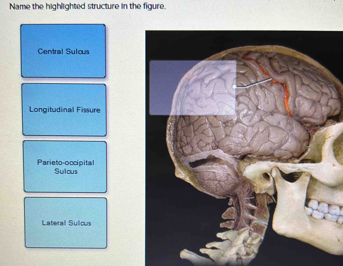Solved: Name the highlighted structure in the figure. Central Sulcus ...