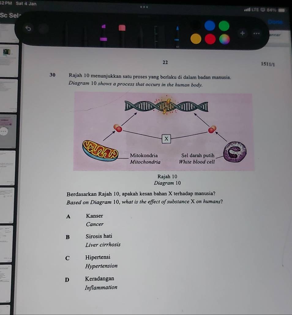 PM Sat 4 Jan

Sc Sel-
+ annar
22 1511/1
30 Rajah 10 menunjukkan satu proses yang berlaku di dalam badan manusia.
Diagram 10 shows a process that occurs in the human body.
Rajah 10
Diagram 10
Berdasarkan Rajah 10, apakah kesan bahan X terhadap manusia?
Based on Diagram 10, what is the effect of substance X on humans?
A Kanser
Cancer
B Sirosis hati
Liver cirrhosis
C Hipertensi
Hypertension
D Keradangan
Inflammation