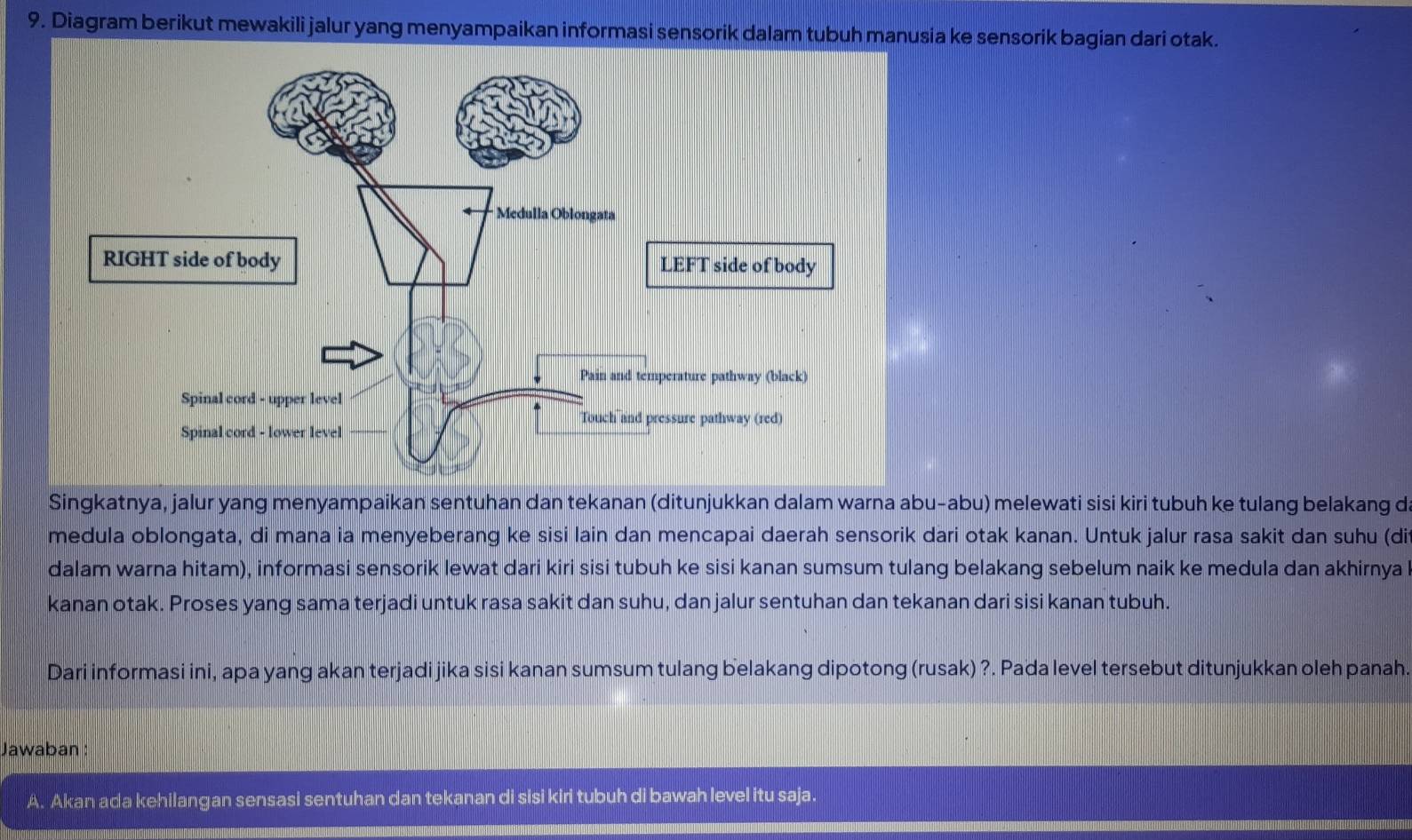 Diagram berikut mewakili jalur yang menyampaikan informasi sensorik dalam tubuh manusia ke sensorik bagian dari otak.
Singkatnya, jalur yang menyampaikan sentuhan dan tekanan (ditunjukkan dalam warna abu-abu) melewati sisi kiri tubuh ke tulang belakang d
medula oblongata, di mana ia menyeberang ke sisi lain dan mencapai daerah sensorik dari otak kanan. Untuk jalur rasa sakit dan suhu (di
dalam warna hitam), informasi sensorik lewat dari kiri sisi tubuh ke sisi kanan sumsum tulang belakang sebelum naik ke medula dan akhirnya
kanan otak. Proses yang sama terjadi untuk rasa sakit dan suhu, dan jalur sentuhan dan tekanan dari sisi kanan tubuh.
Dari informasi ini, apa yang akan terjadi jika sisi kanan sumsum tulang belakang dipotong (rusak) ?. Pada level tersebut ditunjukkan oleh panah.
Jawaban
A. Akan ada kehilangan sensasi sentuhan dan tekanan di sisi kiri tubuh di bawah level itu saja.