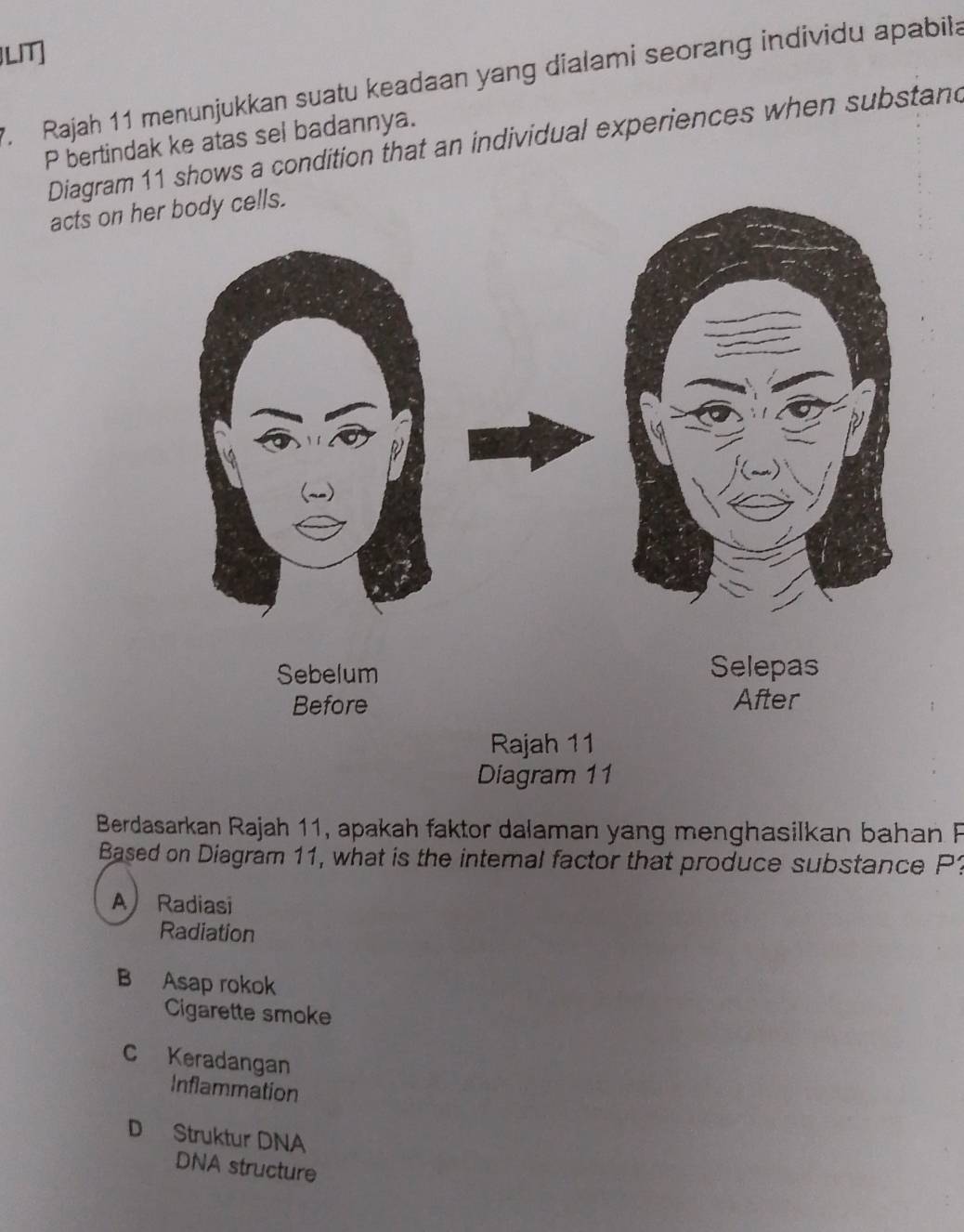 LIT]
. Rajah 11 menunjukkan suatu keadaan yang dialami seorang individu apabila
P bertindak ke atas sel badannya.
Diagram 11 shows a condition that an individual experiences when substand
acts on h
Berdasarkan Rajah 11, apakah faktor dalaman yang menghasilkan bahan F
Based on Diagram 11, what is the internal factor that produce substance P?
A Radiasi
Radiation
B Asap rokok
Cigarette smoke
C Keradangan
Inflammation
D Struktur DNA
DNA structure