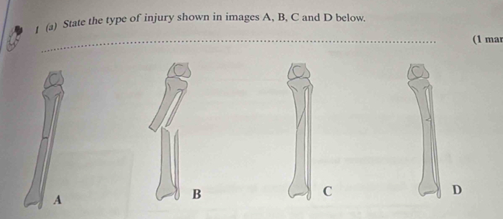 1 (a) State the type of injury shown in images A, B, C and D below. 
(1 mar 
A 
B 
C 
D