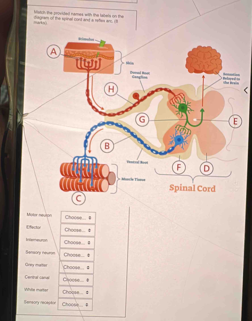 Solved: Match the provided names with the labels on the diagram of the ...