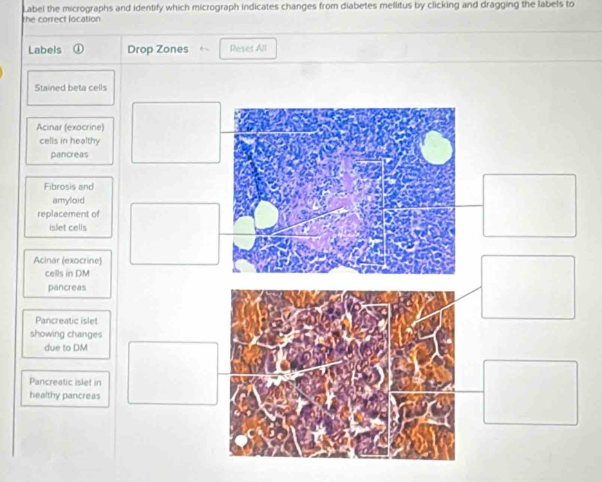 Solved: Label the micrographs and identify which micrograph indicates ...
