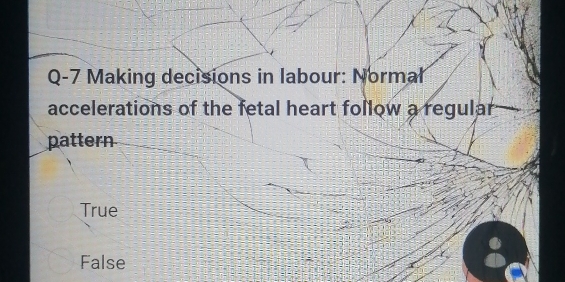 Solved: Q-7 Making decisions in labour: Normal accelerations of the ...
