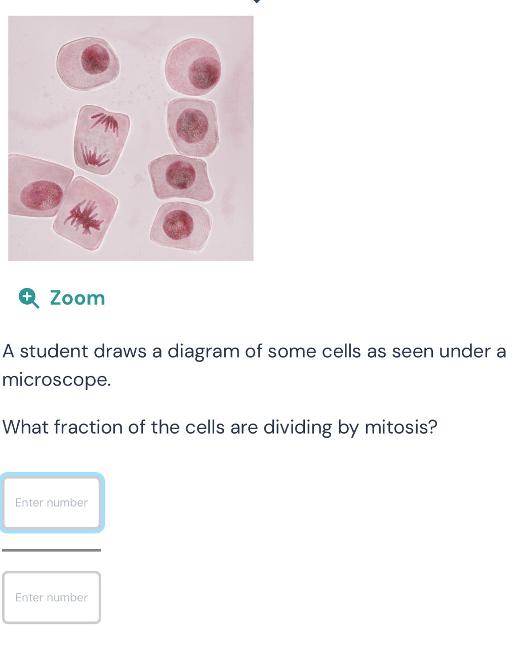 Solved: + Zoom A student draws a diagram of some cells as seen under a ...