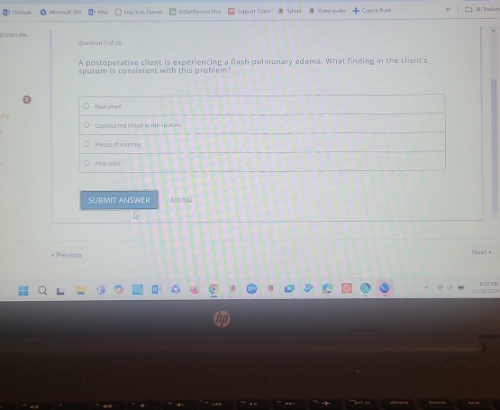 Outlaok Micreseft 365 Lug in to Canves AOSel Serice Plas S upport Tickes Syl lab Video guide Course Po int JU! 3oacm
37/2025 IRN... Question 7 of 20
A postoperative client is experiencing a flash pulmonary edema. What finding in the client's
sputum is consistent with this problem?
Foul smell
Coplousred blood in the spullum
Pieces of vomicus
Pink color
SUBMIT ANSWER Exit qu z
* Previous Next=
11/16/2014 BOO P M
hp