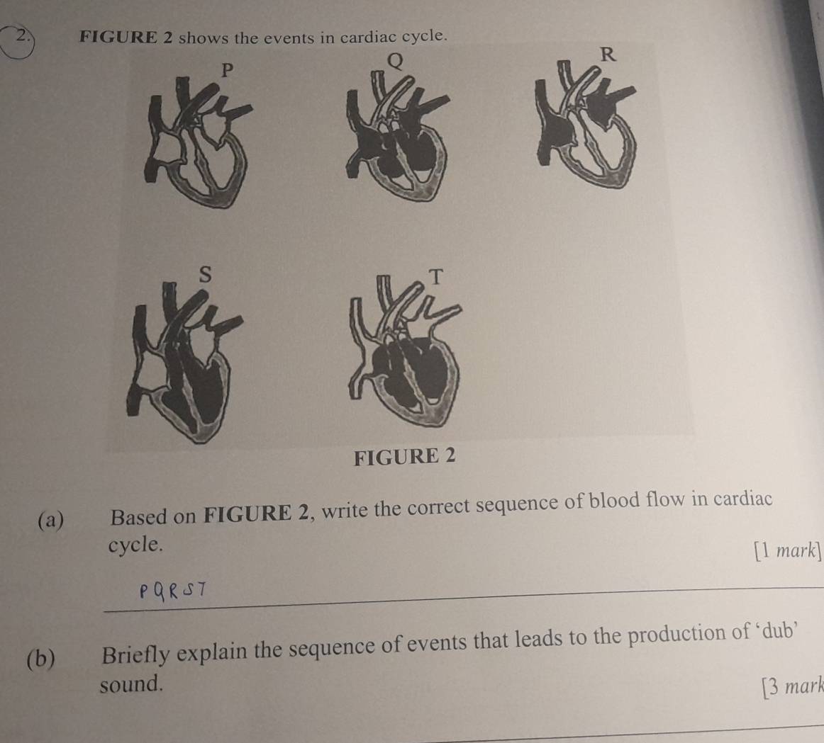 FIGURE 2 shows the events in cardiac cycle. 
Q 
R 
s 
T 
FIGURE 2 
(a) Based on FIGURE 2, write the correct sequence of blood flow in cardiac 
cycle. [1 mark] 
_ 
(b) Briefly explain the sequence of events that leads to the production of ‘dub’ 
sound. [3 mark 
_ 
_ 
_