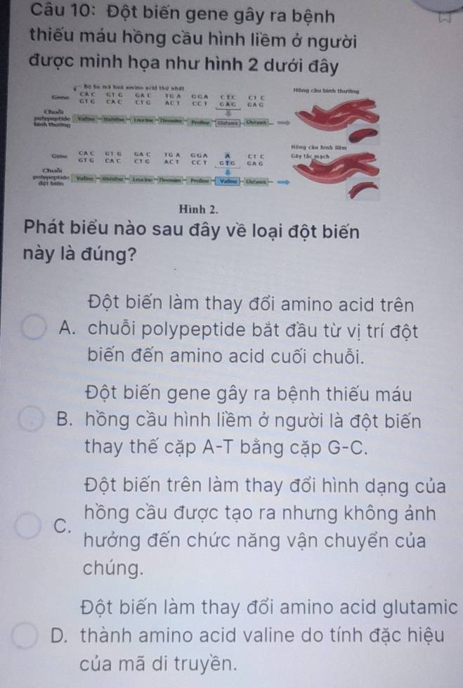 Đột biến gene gây ra bệnh
thiếu máu hồng cầu hình liềm ở người
được minh họa như hình 2 dưới đây
CA C Bộ Đn mã hoó amino arh thứ nhất Hồng cầu bình thường
“1 G G A C 1 G A
Gone G1 C CA C cr a ACT G G A cC 1 G A G C t c C A C C l C
Chuỗi 8
hình themg polypeptide Vxtown— Matition — Leacin - Tenomno Preier '* Clutaes )- Getent
Hồng cầu hình liêm
CA C G1 6 GA C A
Geoe GTG CA C a1 6 AC T T G A G G A CC T G T G c1 C Gây tắc mạch
Chuỗi GA G
potypeptión đột biến Valine- tstidne —Teocine - Teoman- Profne Valsa-Ghitenk- ===
Hình 2.
Phát biểu nào sau đây về loại đột biến
này là đúng?
Đột biến làm thay đổi amino acid trên
A. chuỗi polypeptide bắt đầu từ vị trí đột
biến đến amino acid cuối chuỗi.
Đột biến gene gây ra bệnh thiếu máu
B. hồng cầu hình liềm ở người là đột biến
thay thế cặp A-T bằng cặp G-C.
Đột biến trên làm thay đổi hình dạng của
C. hồng cầu được tạo ra nhưng không ảnh
hưởng đến chức năng vận chuyển của
chúng.
Đột biến làm thay đổi amino acid glutamic
D. thành amino acid valine do tính đặc hiệu
của mã di truyền.