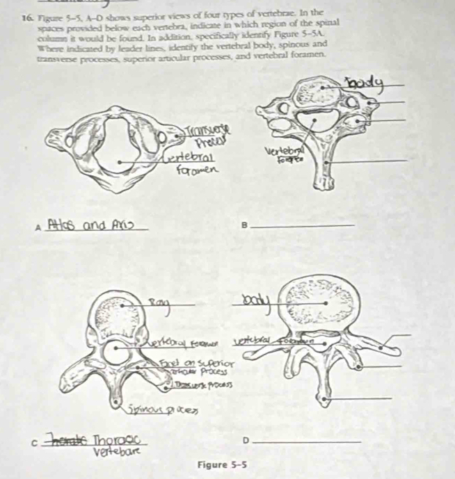 Figure 5-5, A--D shows superior views of four types of vertebrae. In the 
spaces provided below each vertebra, indicate in which region of the spinal 
column it would be found. In addition, specifically identify Figure 5-5A. 
Where indicated by leader lines, identify the vertebral body, spinous and 
transverse processes, superior articular processes, and vertebral foramen. 
_A 
_B 
_ 
_ 
_ 
_ 
a 
finel s po r 
P erk Process 
C _Thoro 
_D 
Figure 5-5