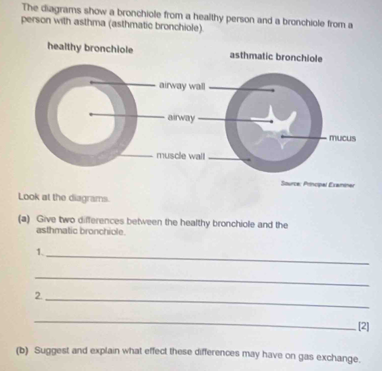 The diagrams show a bronchiole from a healthy person and a bronchiole from a 
person with asthma (asthmatic bronchiole). 
Source: Principal Examiner 
Look at the diagrams. 
(a) Give two differences between the healthy bronchiole and the 
asthmatic bronchiole. 
1._ 
_ 
2._ 
_ 
[2] 
(b) Suggest and explain what effect these differences may have on gas exchange.