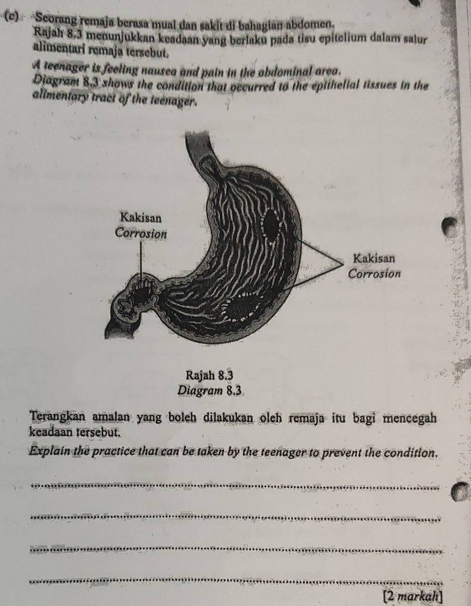 Scorang remaja berasa mual dan saki di bahagián abdomen. 
Rajah 8.3 menunjukkan keadaan yang berlaku pada tisu epitelium dalam salur 
alimentari remaja tersebut. 
A teenager is feeling nausea and pain in the abdominal area. 
Diagram 8.3 shows the condition that occurred to the epithelial tissues in the 
alimentary tract of the teenager. 
Rajah 8.3 
Diagram 8.3 
Terangkan amalan yang boleh dilakukan oleh remaja itu bagi mencegah 
keadaan tersebut. 
Explain the practice that can be taken by the teenager to prevent the condition. 
_ 
_ 
_ 
_ 
[2 markah]